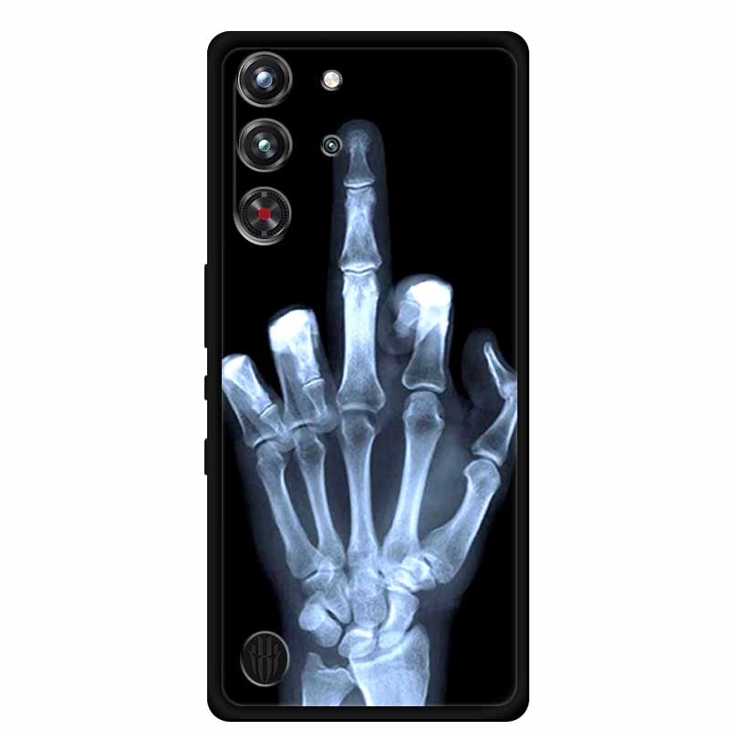 Voor ZTE nubia Red Magic 10 Pr - Redmagic Tablet Accessories recensie en prijs